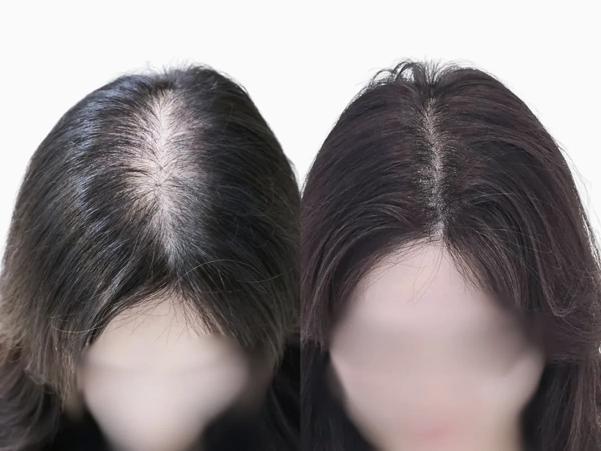 결과 설계 이미지