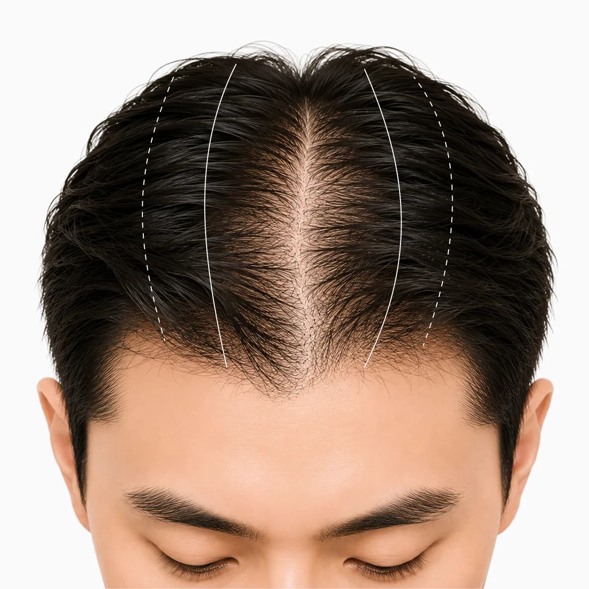 남성 가르마와 정수리 이미지